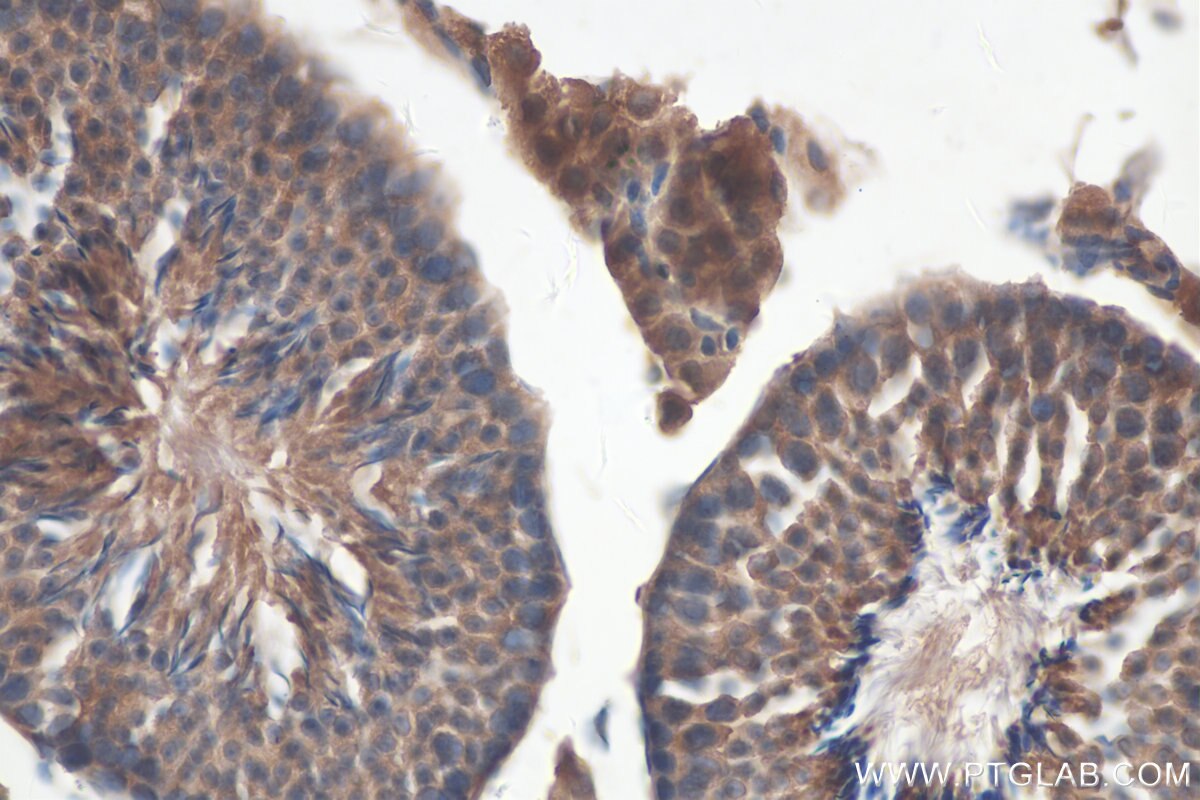 Immunohistochemistry (IHC) staining of mouse testis tissue using MTIF3 Polyclonal antibody (14219-1-AP)