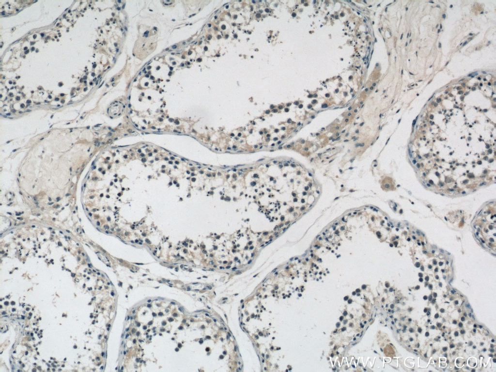 Immunohistochemistry (IHC) staining of human testis tissue using MTIF3 Polyclonal antibody (14219-1-AP)