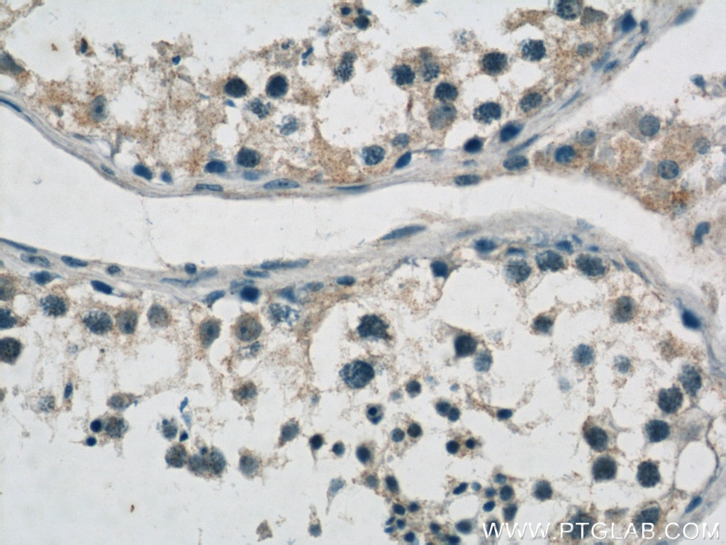 Immunohistochemistry (IHC) staining of human testis tissue using MTIF3 Polyclonal antibody (14219-1-AP)