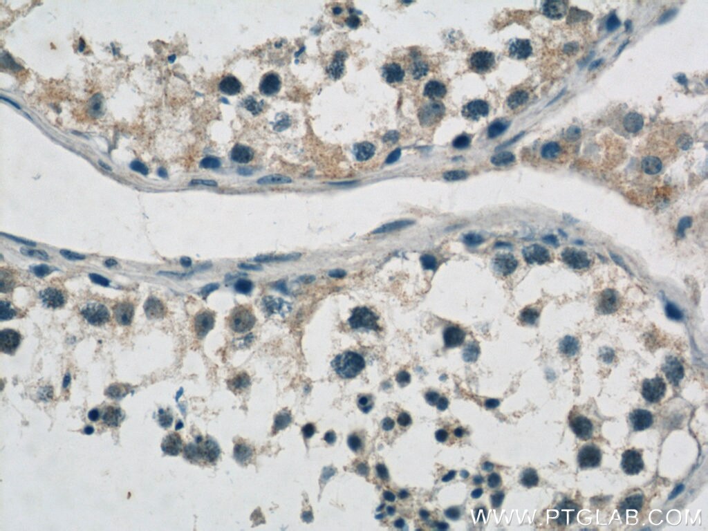 IHC staining of human testis using 14219-1-AP