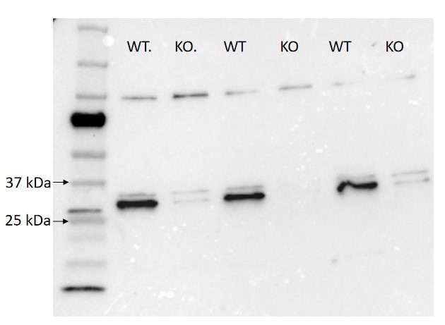 Western Blot (WB) analysis of human preadipocyte cells using MTIF3 Polyclonal antibody (14219-1-AP)