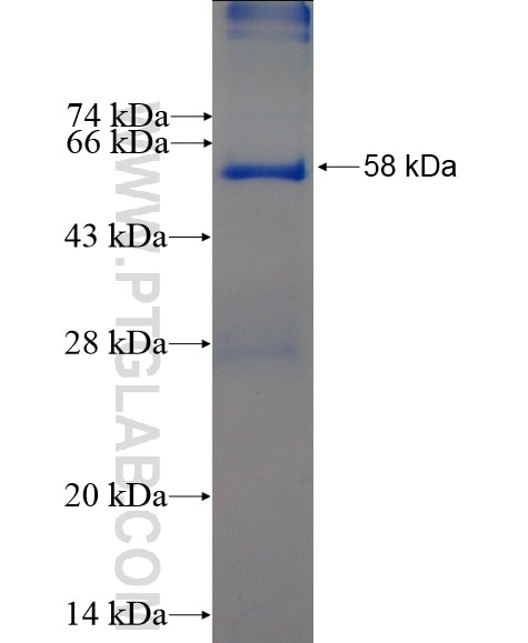 MTIF3 fusion protein Ag5457 SDS-PAGE