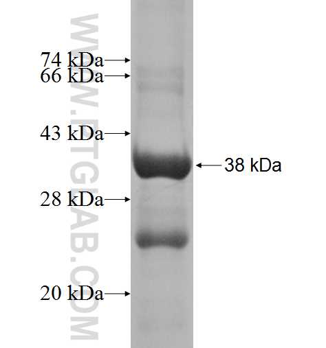 MTIF3 fusion protein Ag5643 SDS-PAGE