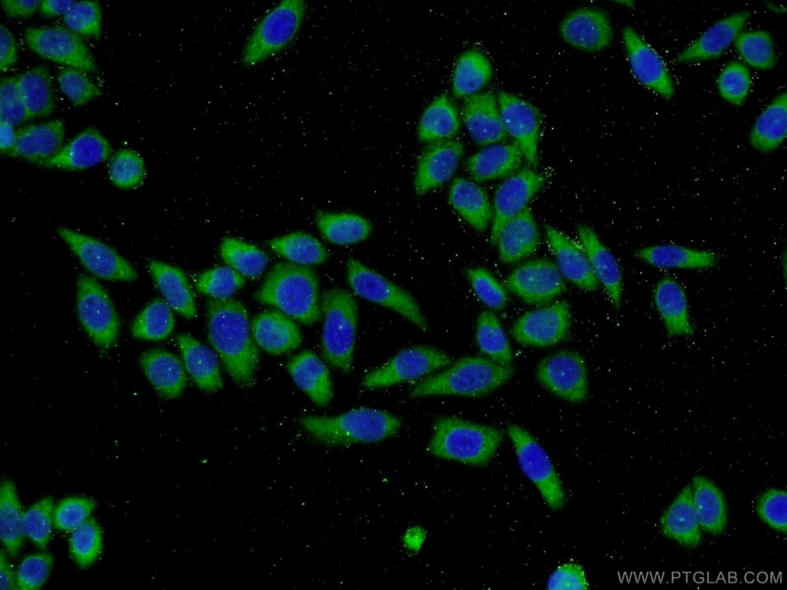 Immunofluorescence (IF) / fluorescent staining of L02 cells using MTM1 Polyclonal antibody (13924-1-AP)