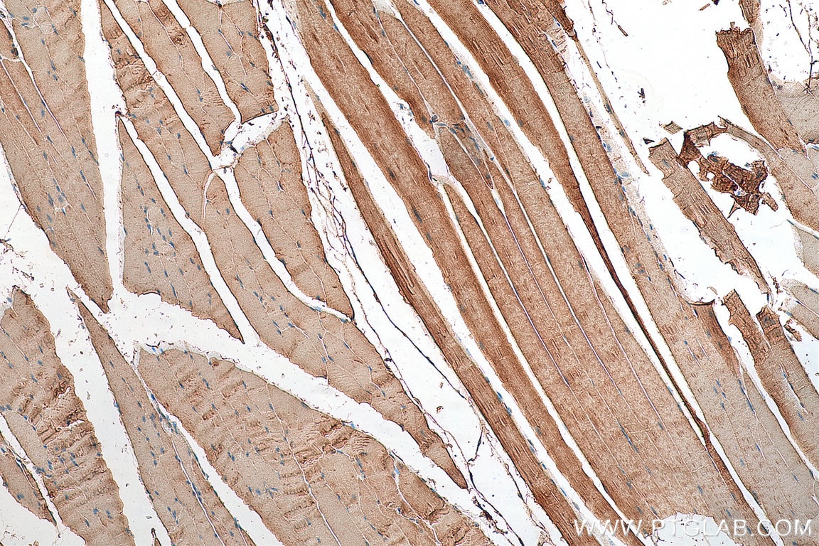 Immunohistochemistry (IHC) staining of mouse skeletal muscle tissue using MTM1 Polyclonal antibody (13924-1-AP)