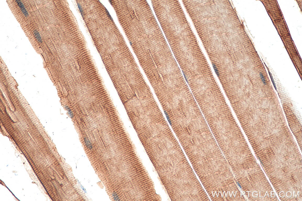 Immunohistochemistry (IHC) staining of mouse skeletal muscle tissue using MTM1 Polyclonal antibody (13924-1-AP)