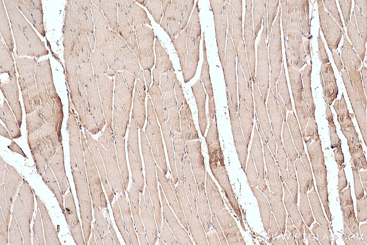 Immunohistochemistry (IHC) staining of rat skeletal muscle tissue using MTM1 Polyclonal antibody (13924-1-AP)