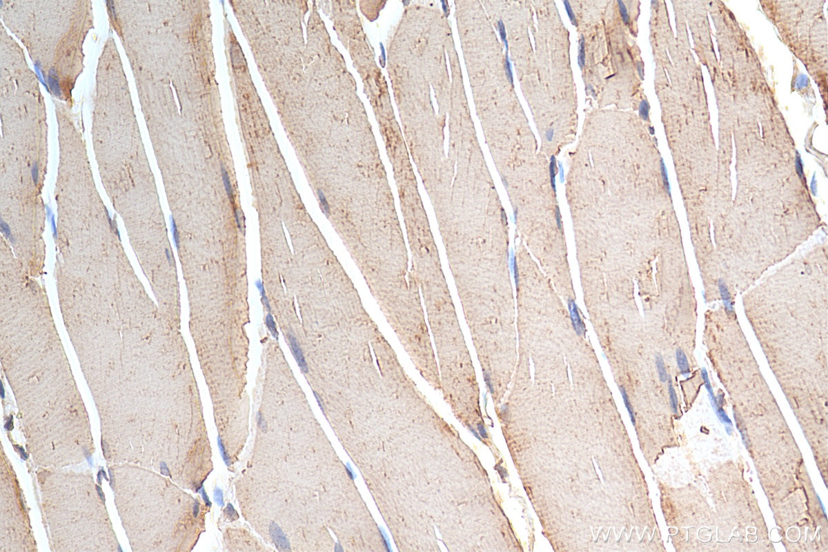 Immunohistochemistry (IHC) staining of rat skeletal muscle tissue using MTM1 Polyclonal antibody (13924-1-AP)