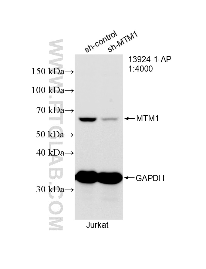Western Blot (WB) analysis of Jurkat cells using MTM1 Polyclonal antibody (13924-1-AP)