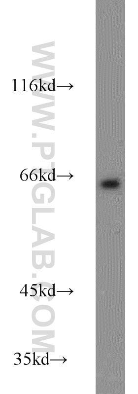 Western Blot (WB) analysis of Jurkat cells using MTM1 Polyclonal antibody (13924-1-AP)