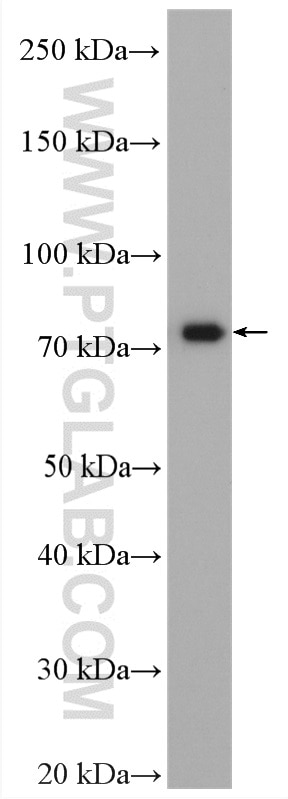 Western Blot (WB) analysis of K-562 cells using MTMR12 Polyclonal antibody (17552-1-AP)