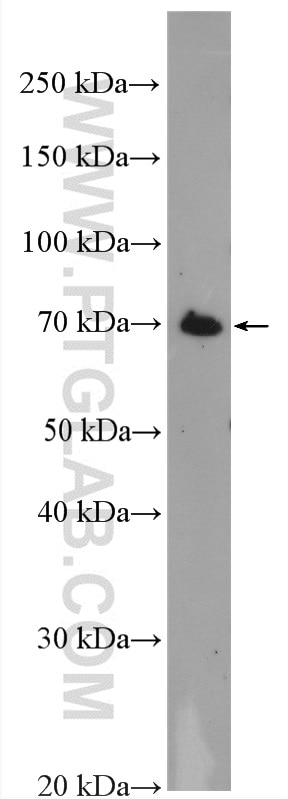 Western Blot (WB) analysis of HEK-293 cells using MTMR12 Polyclonal antibody (17552-1-AP)