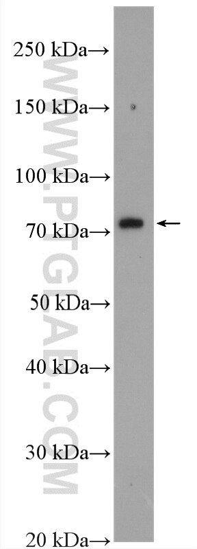 Western Blot (WB) analysis of mouse brain tissue using MTMR12 Polyclonal antibody (17552-1-AP)