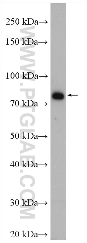 Western Blot (WB) analysis of K-562 cells using MTMR12 Polyclonal antibody (17552-1-AP)