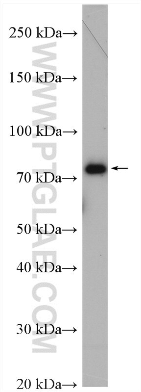 Western Blot (WB) analysis of HEK-293 cells using MTMR12 Polyclonal antibody (17552-1-AP)