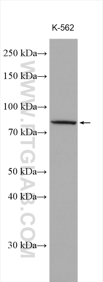 Western Blot (WB) analysis of various lysates using MTMR12 Polyclonal antibody (17552-1-AP)
