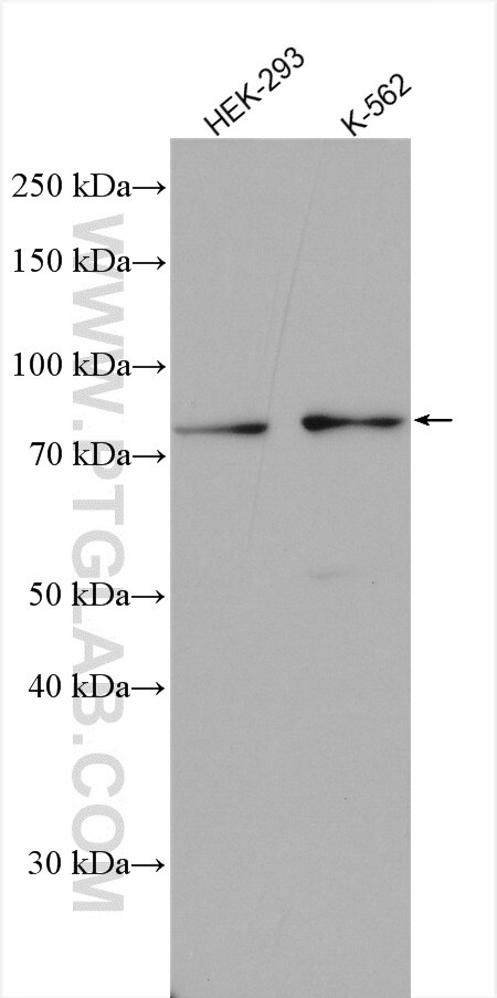 Western Blot (WB) analysis of various lysates using MTMR12 Polyclonal antibody (17552-1-AP)