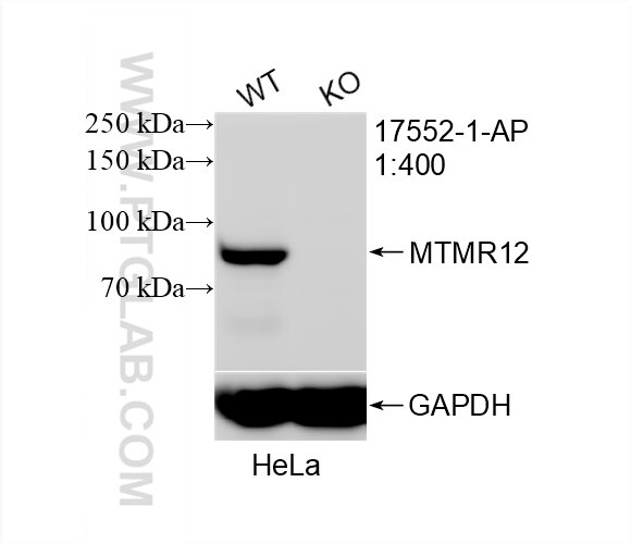 Western Blot (WB) analysis of HeLa cells using MTMR12 Polyclonal antibody (17552-1-AP)