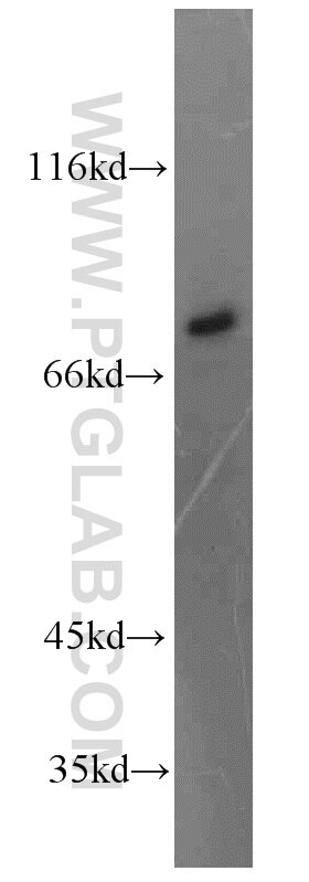 Western Blot (WB) analysis of mouse lung tissue using MTMR12 Polyclonal antibody (17552-1-AP)