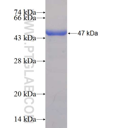 MTMR12 fusion protein Ag11870 SDS-PAGE