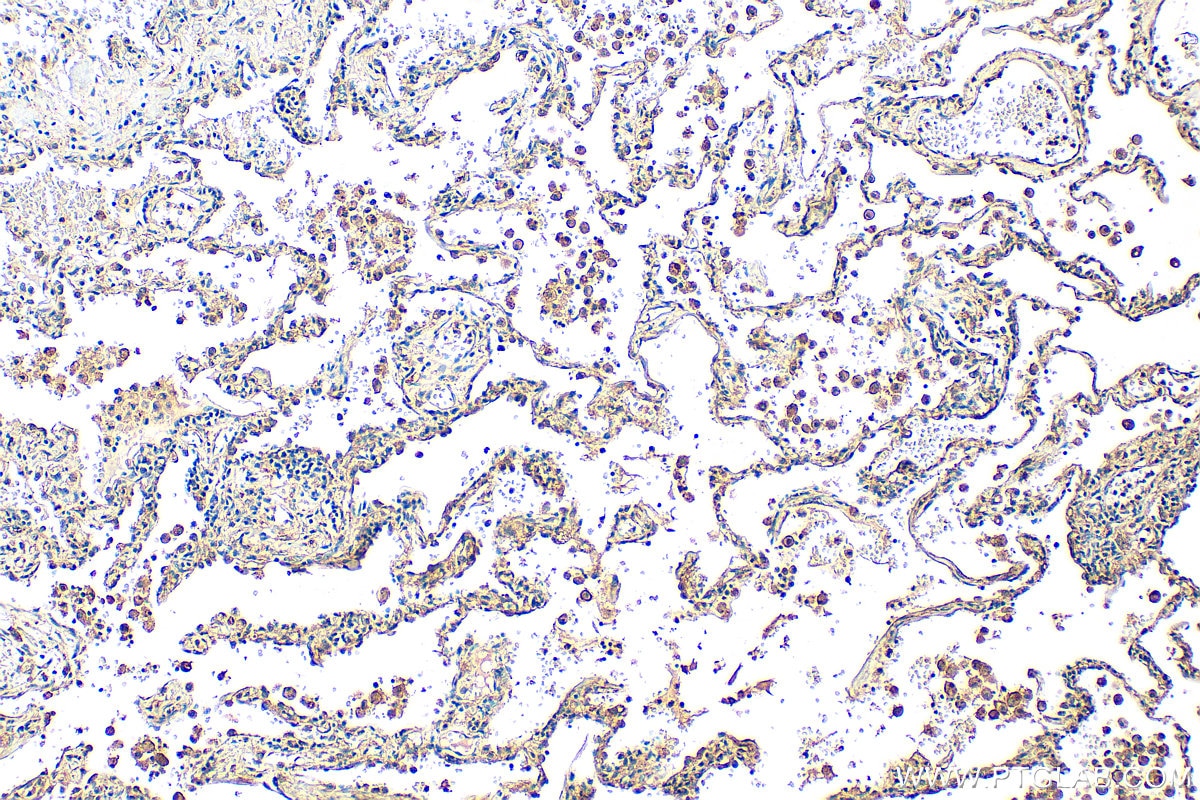 Immunohistochemistry (IHC) staining of human lung tissue using MTMR14 Polyclonal antibody (14973-1-AP)