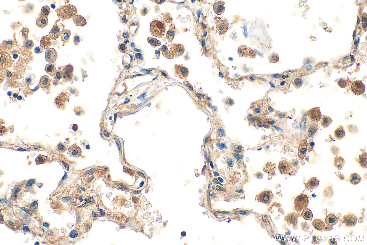 Immunohistochemistry (IHC) staining of human lung tissue using MTMR14 Polyclonal antibody (14973-1-AP)