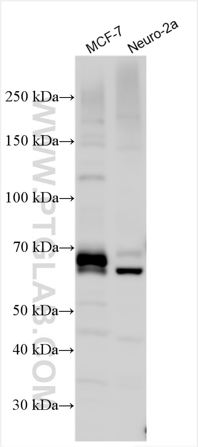 Western Blot (WB) analysis of various lysates using MTMR14 Polyclonal antibody (28496-1-AP)