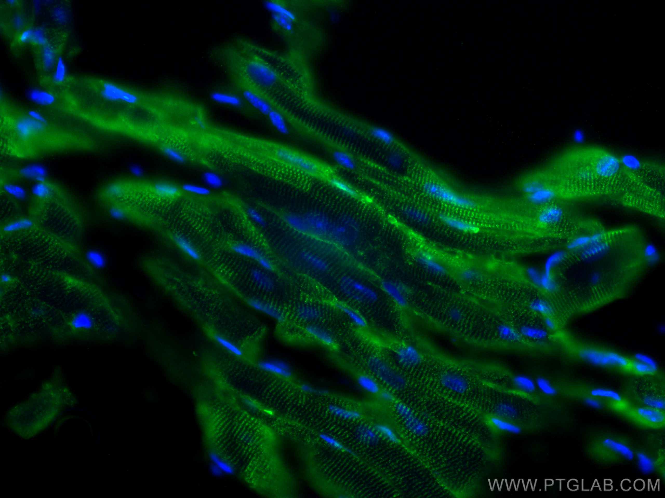 Immunofluorescence (IF) / fluorescent staining of mouse heart tissue using MTMR14 Monoclonal antibody (67561-1-Ig)