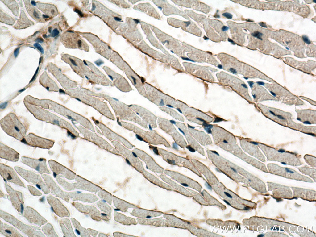 Immunohistochemistry (IHC) staining of mouse heart tissue using MTMR14 Monoclonal antibody (67561-1-Ig)