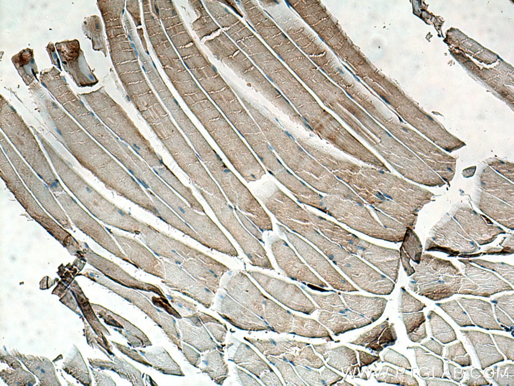 Immunohistochemistry (IHC) staining of mouse skeletal muscle tissue using MTMR14 Monoclonal antibody (67561-1-Ig)