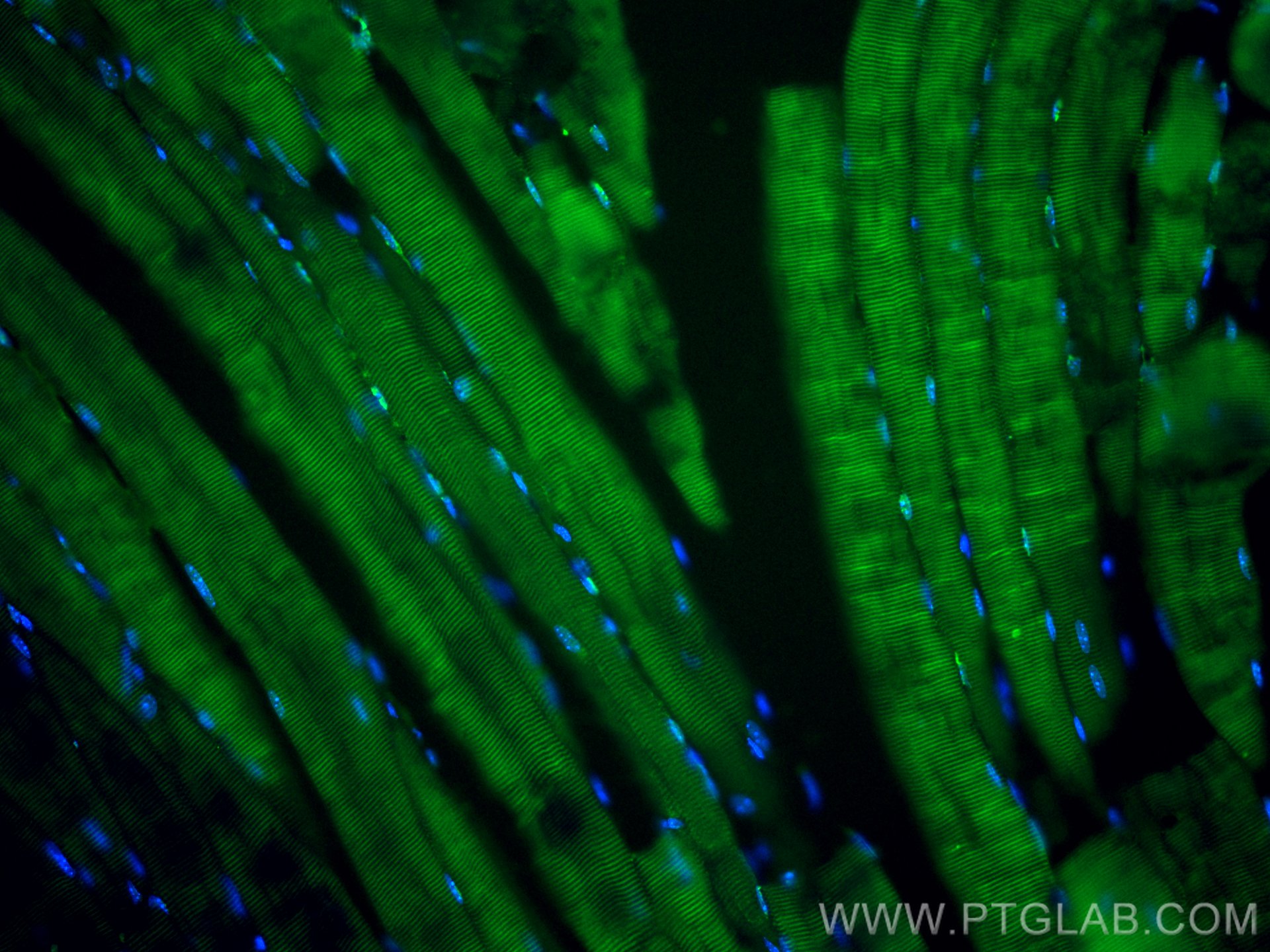 Immunofluorescence (IF) / fluorescent staining of mouse skeletal muscle tissue using CoraLite® Plus 488-conjugated MTMR14 Monoclonal an (CL488-67561)
