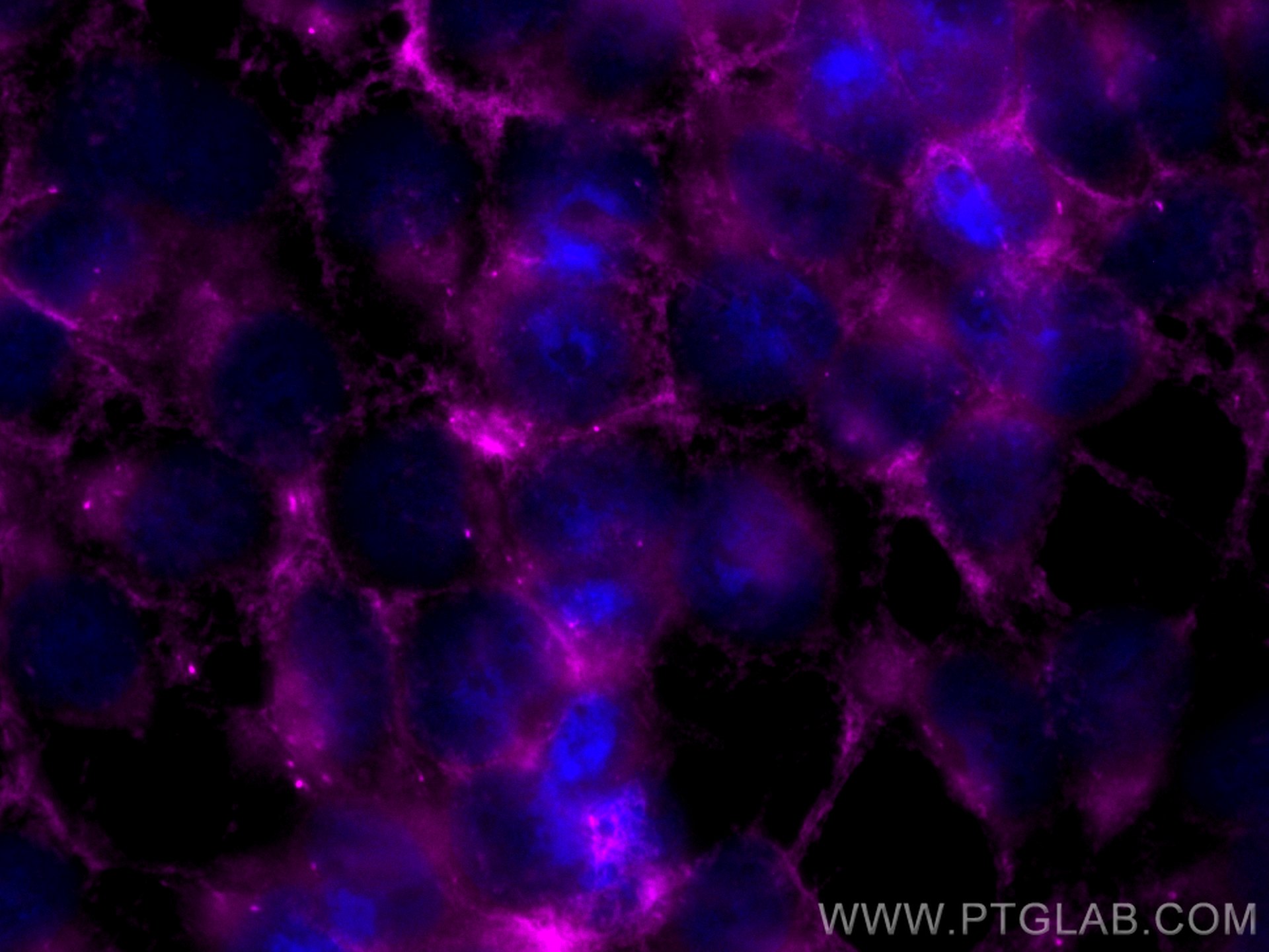 Immunofluorescence (IF) / fluorescent staining of HEK-293 cells using CoraLite® Plus 647-conjugated MTMR14 Monoclonal an (CL647-67561)