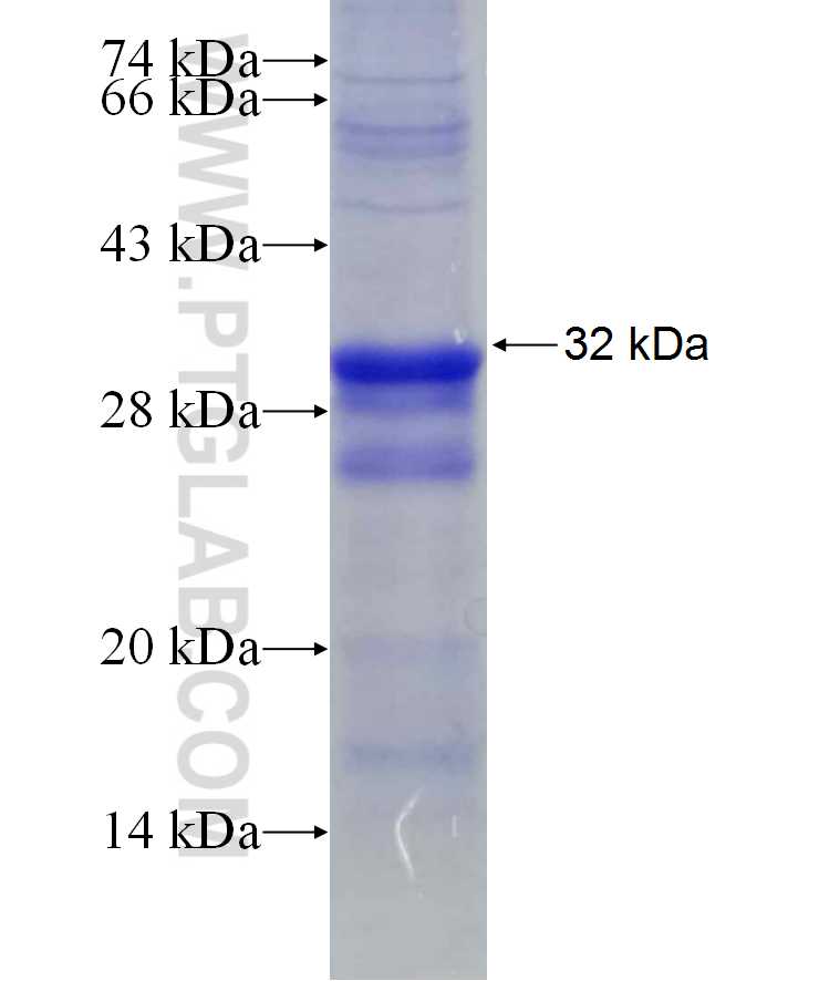 MTMR14 fusion protein Ag29627 SDS-PAGE