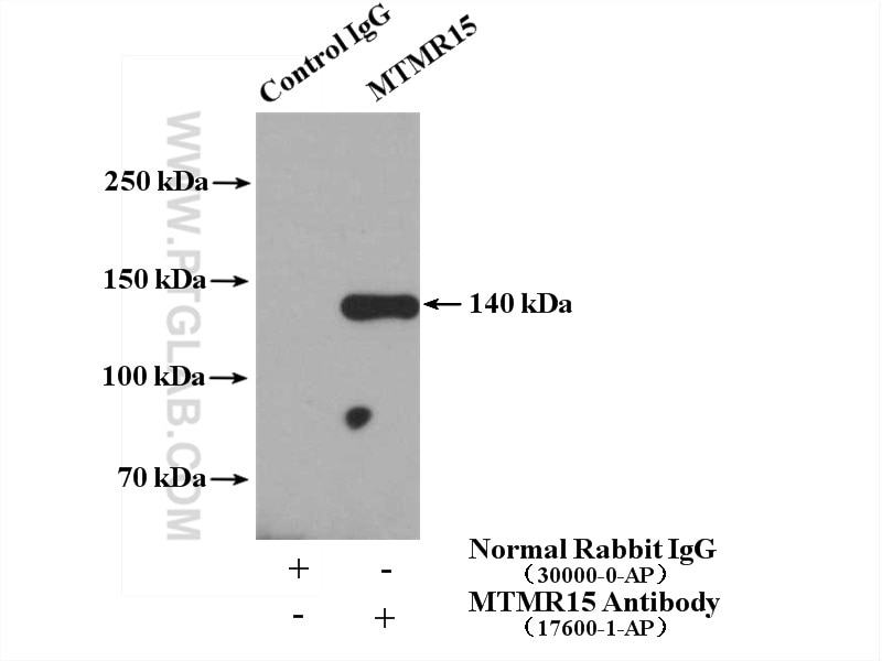 Immunoprecipitation (IP) experiment of HeLa cells using MTMR15 Polyclonal antibody (17600-1-AP)