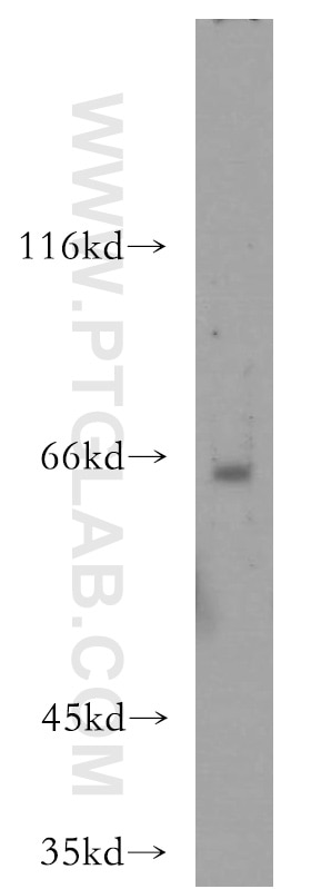 Western Blot (WB) analysis of human spleen tissue using MTMR15 Polyclonal antibody (17600-1-AP)