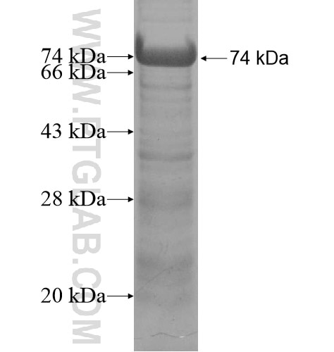 MTMR15 fusion protein Ag11651 SDS-PAGE