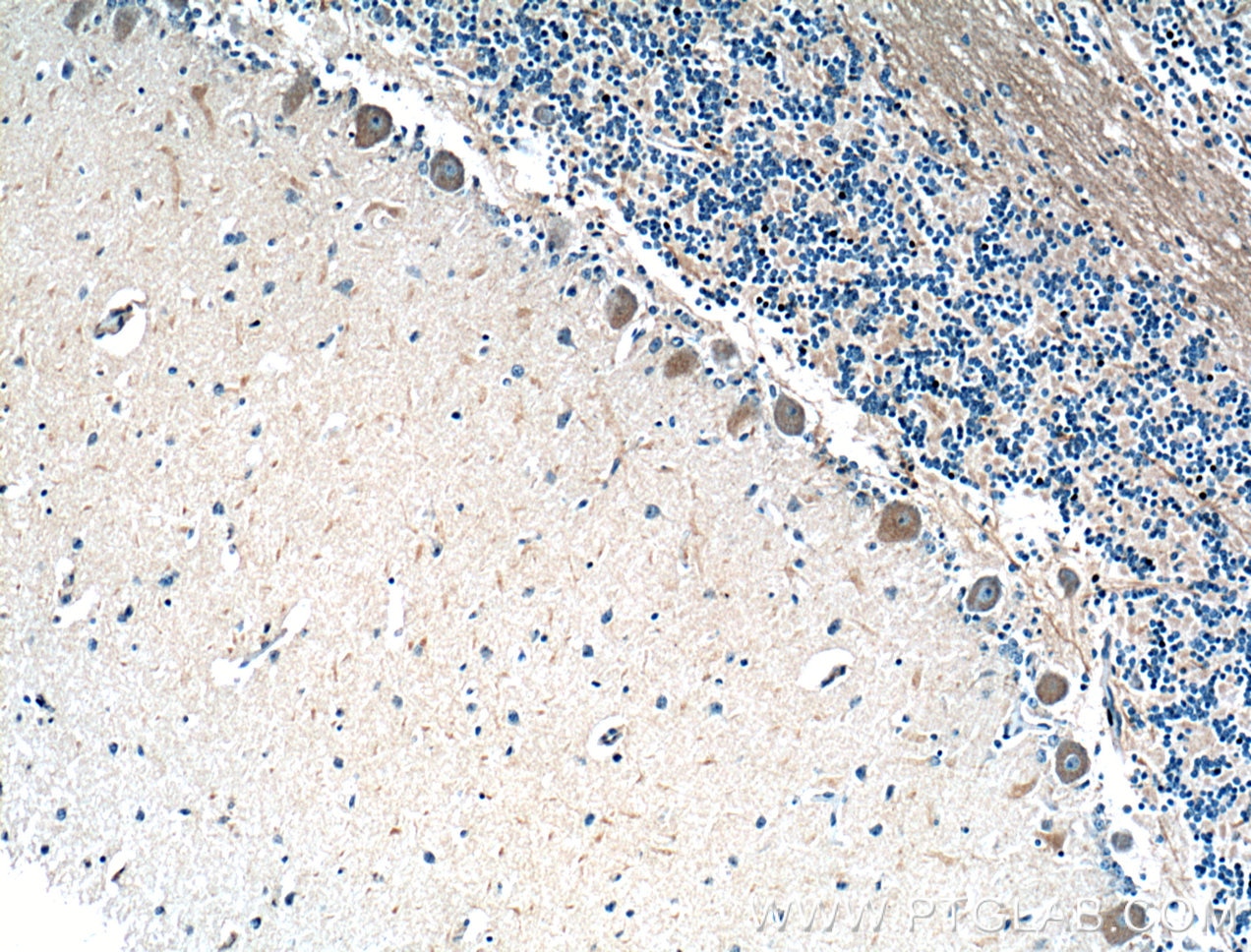 Immunohistochemistry (IHC) staining of human cerebellum tissue using MTMR2 Polyclonal antibody (14372-1-AP)