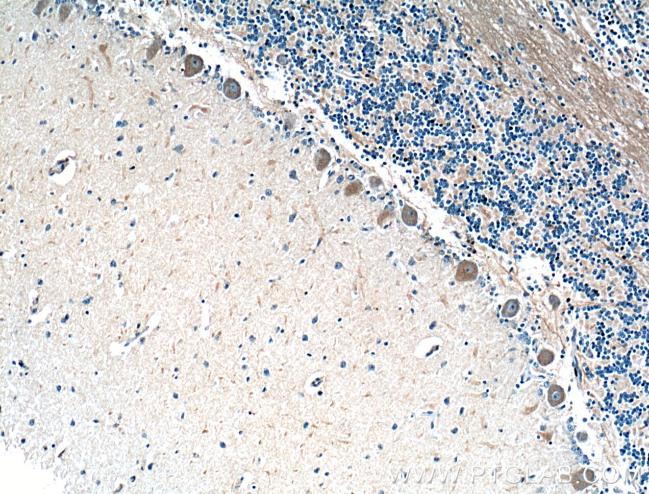 Immunohistochemistry (IHC) staining of human cerebellum tissue using MTMR2 Polyclonal antibody (14372-1-AP)