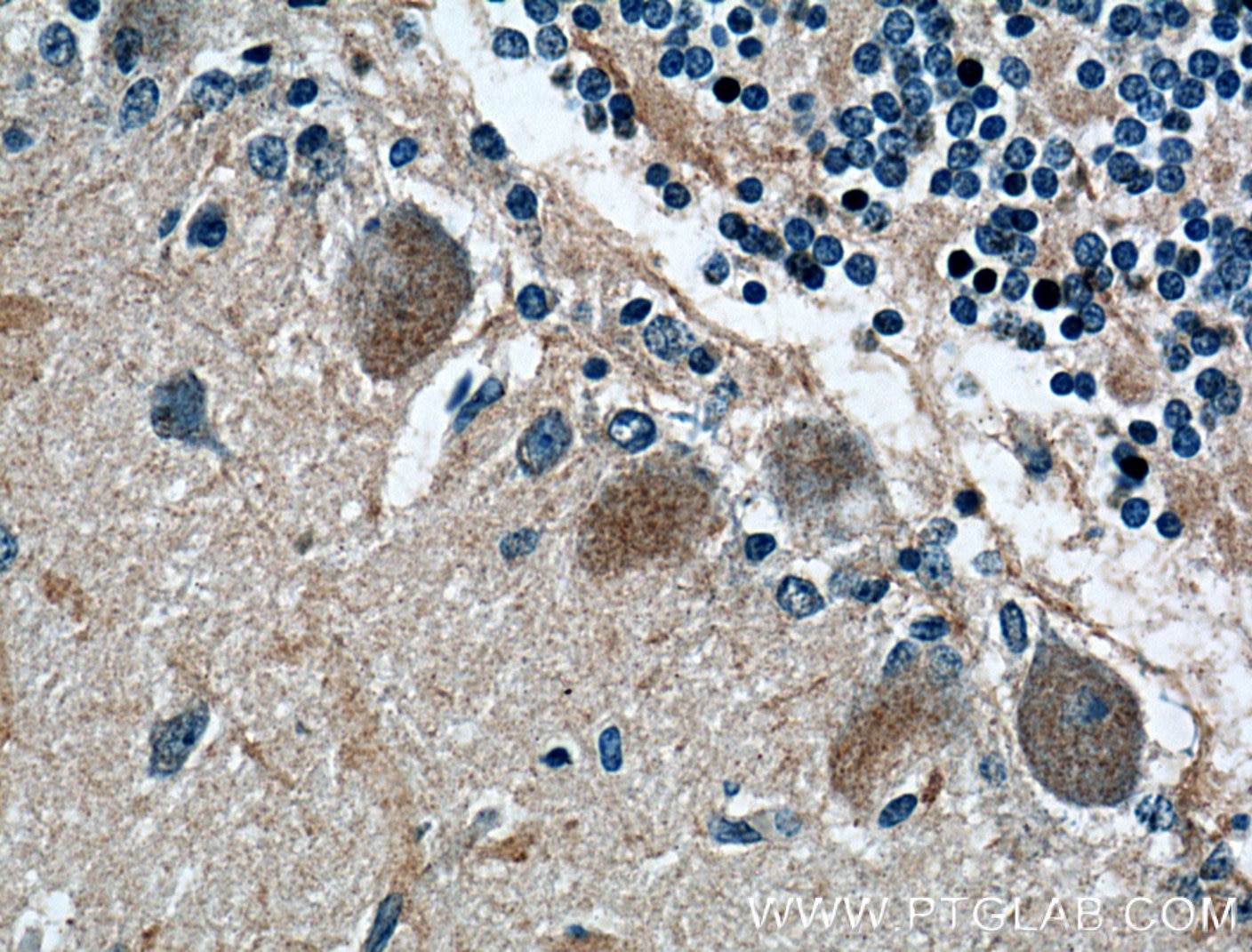 Immunohistochemistry (IHC) staining of human cerebellum tissue using MTMR2 Polyclonal antibody (14372-1-AP)