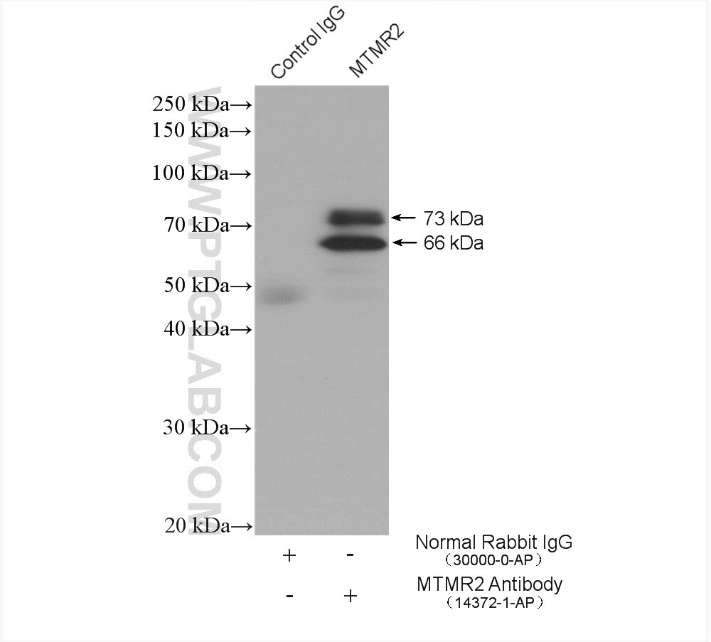 Immunoprecipitation (IP) experiment of mouse cerebellum tissue using MTMR2 Polyclonal antibody (14372-1-AP)