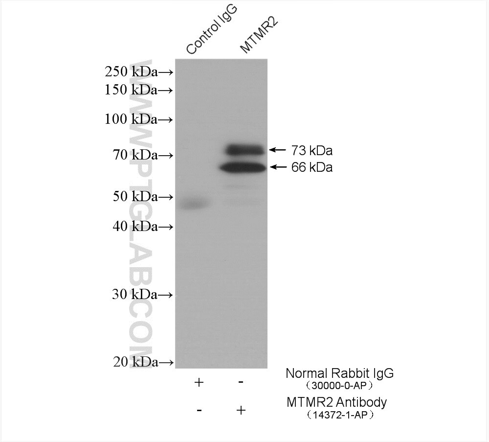 IP experiment of mouse cerebellum using 14372-1-AP