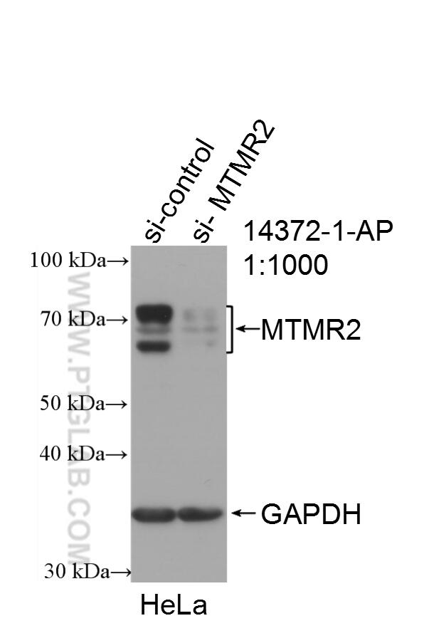 Western Blot (WB) analysis of HeLa cells using MTMR2 Polyclonal antibody (14372-1-AP)