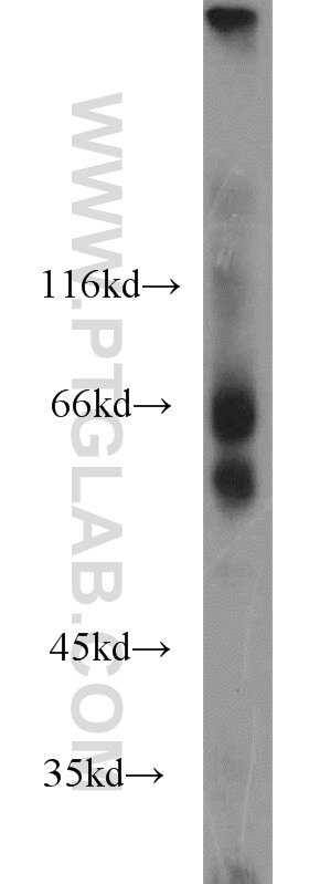 Western Blot (WB) analysis of human cerebellum tissue using MTMR2 Polyclonal antibody (14372-1-AP)