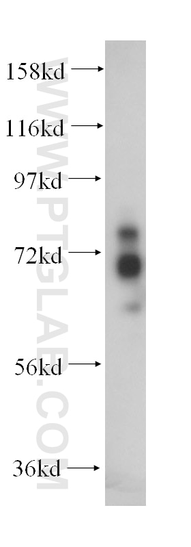 Western Blot (WB) analysis of human cerebellum tissue using MTMR2 Polyclonal antibody (14372-1-AP)