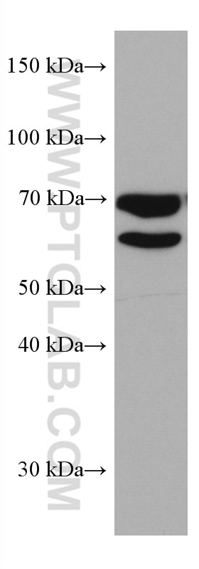 Western Blot (WB) analysis of HeLa cells using MTMR2 Monoclonal antibody (67312-1-Ig)