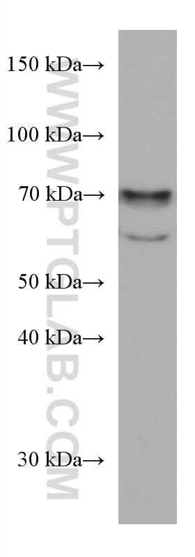 Western Blot (WB) analysis of HEK-293 cells using MTMR2 Monoclonal antibody (67312-1-Ig)