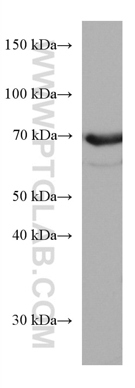 Western Blot (WB) analysis of Jurkat cells using MTMR2 Monoclonal antibody (67312-1-Ig)