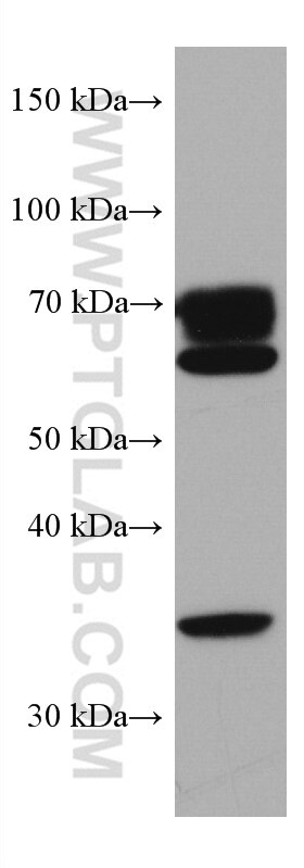Western Blot (WB) analysis of pig brain tissue using MTMR2 Monoclonal antibody (67312-1-Ig)