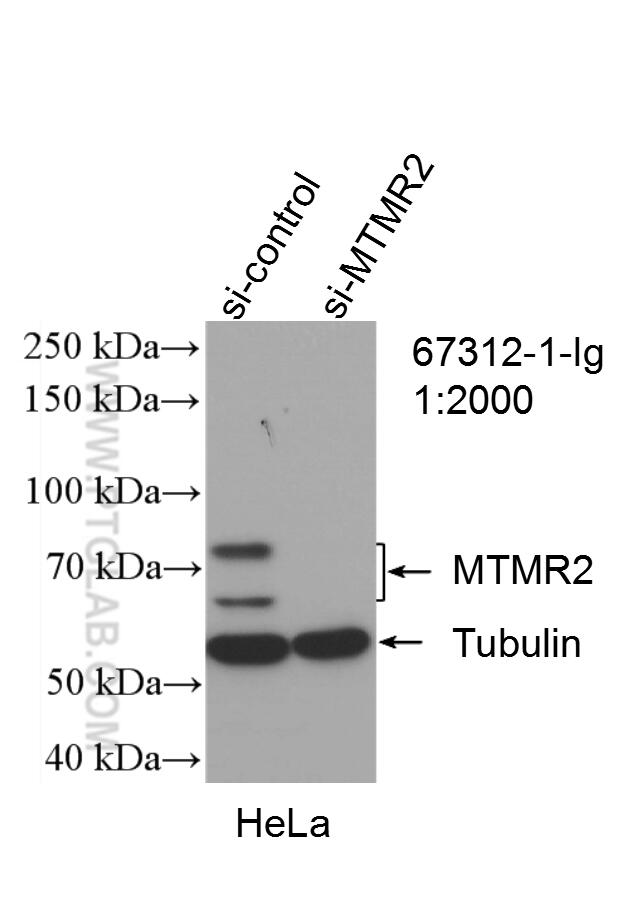 Western Blot (WB) analysis of HeLa cells using MTMR2 Monoclonal antibody (67312-1-Ig)