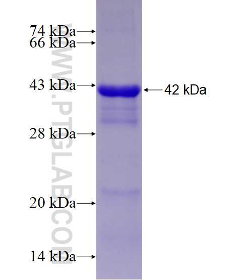 MTMR2 fusion protein Ag28413 SDS-PAGE